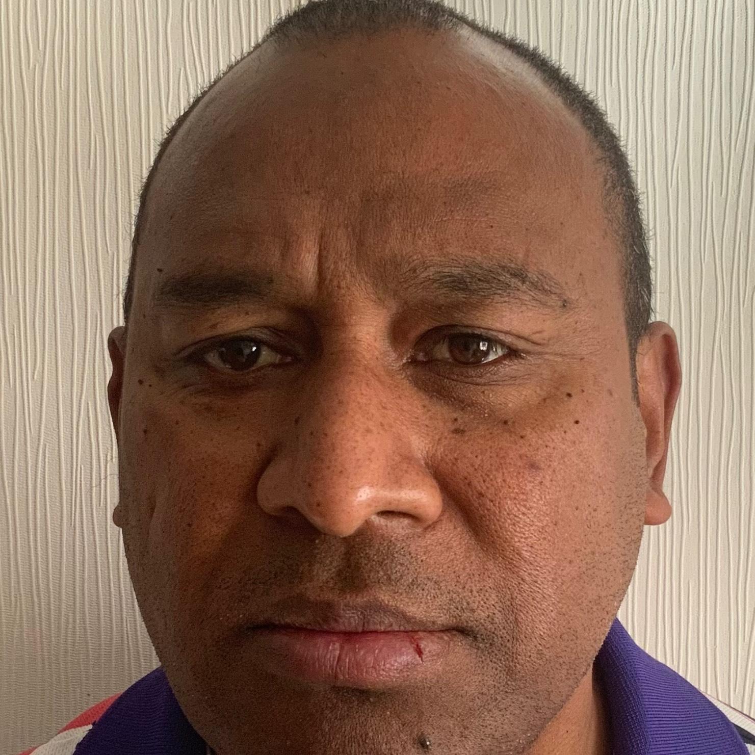 MOSESE TEKEI